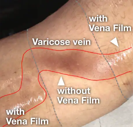 Venafilm-03